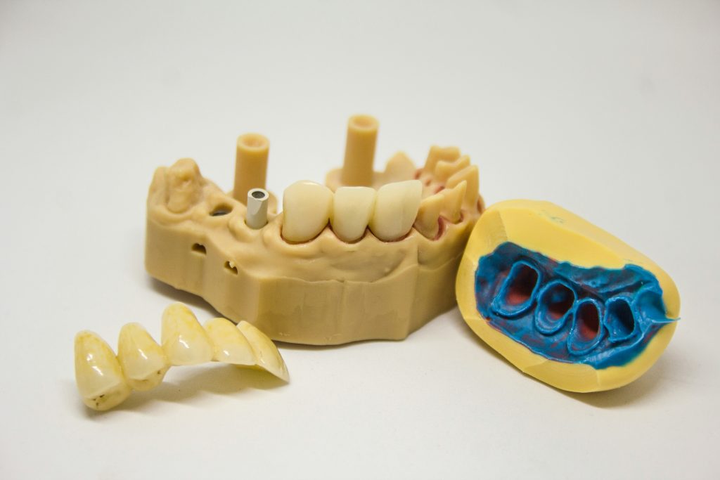 how much does a dental crown cost