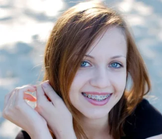 Traditional Braces