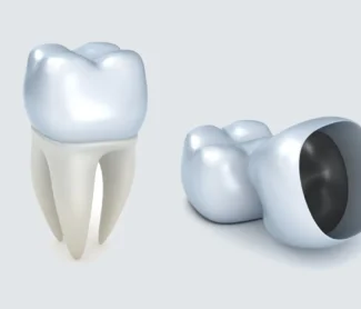 Dental Crowns