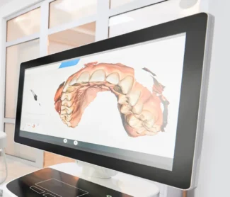 Oral Cancer Screenings