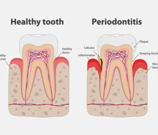 Periodontics