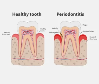 Periodontics in Carson, CA | Periodontics near you in 90745