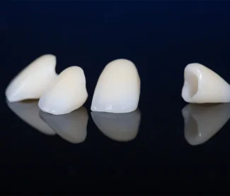 How Much Does a Dental Crown Cost? Complete Guide!