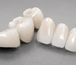 Veneers vs Crowns – All You Need to Know!